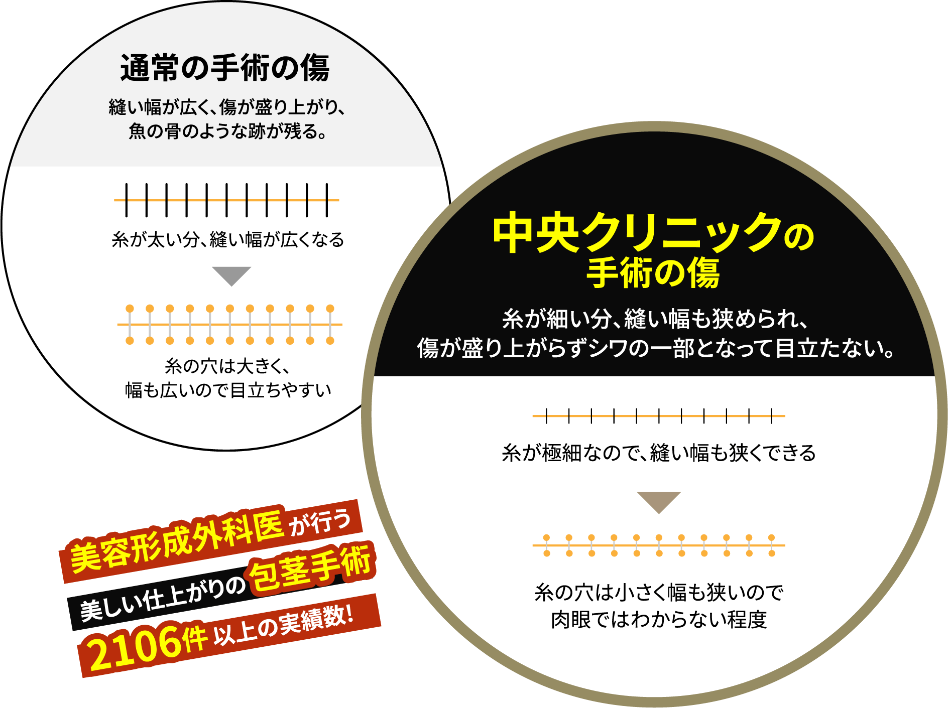 中央クリニックの手術の傷