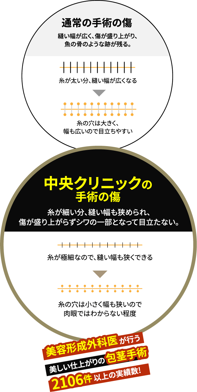 中央クリニックの手術の傷