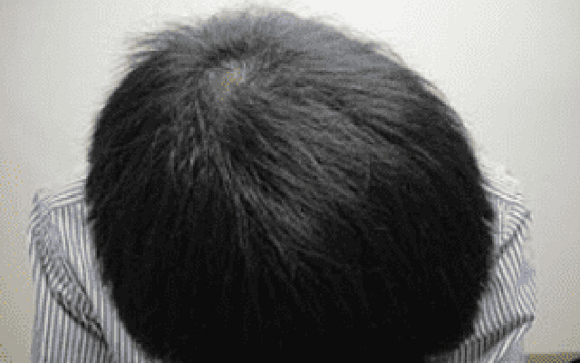 治療後