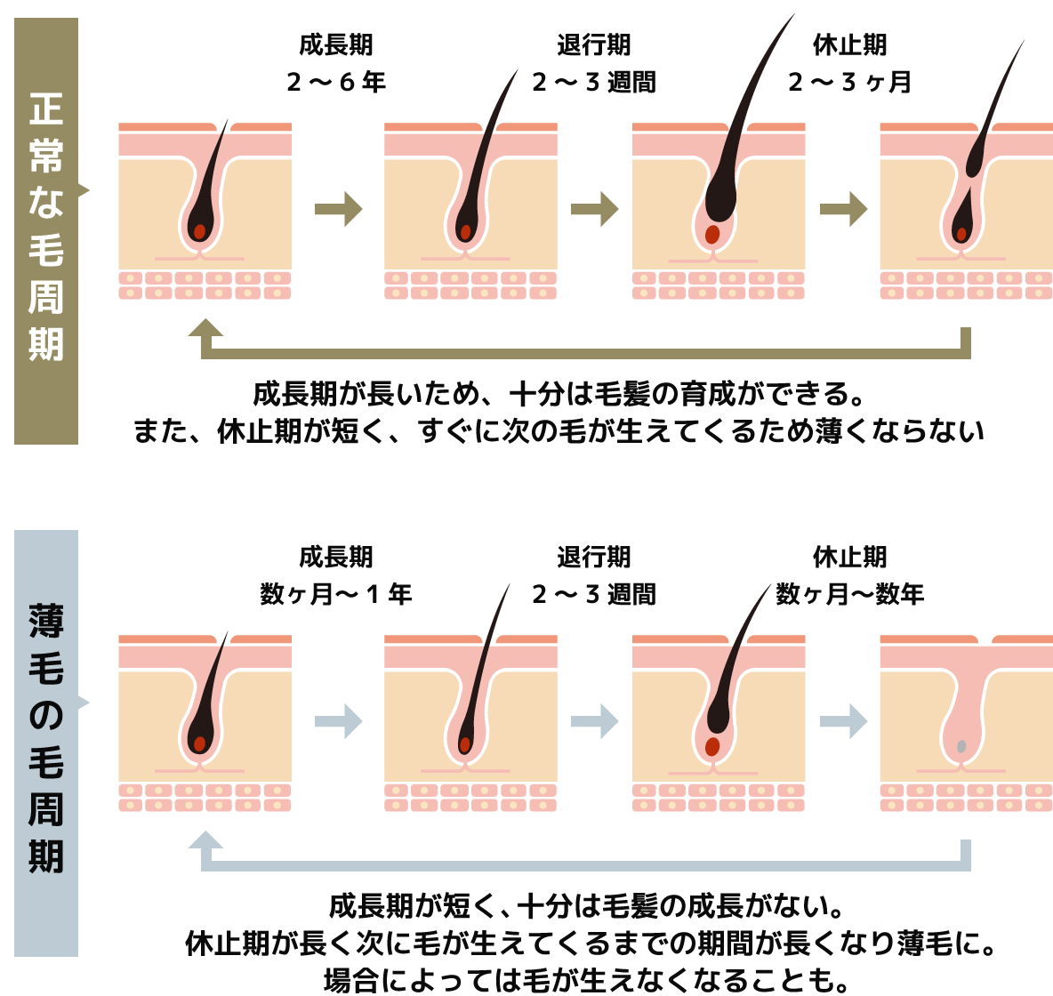 正常な毛周期と薄毛の毛周期