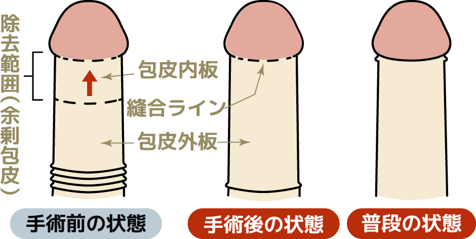 手術前の状態、手術後の状態・普段の状態