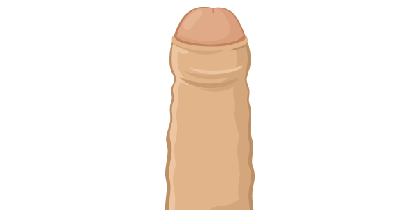 仮性包茎