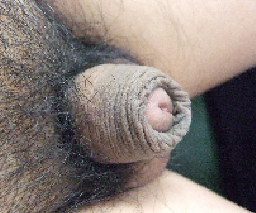 治療前