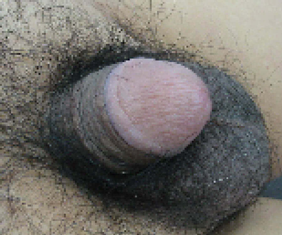 治療前