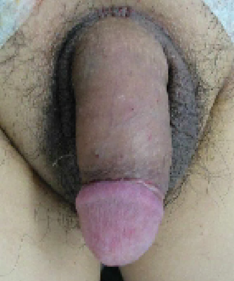 治療後
